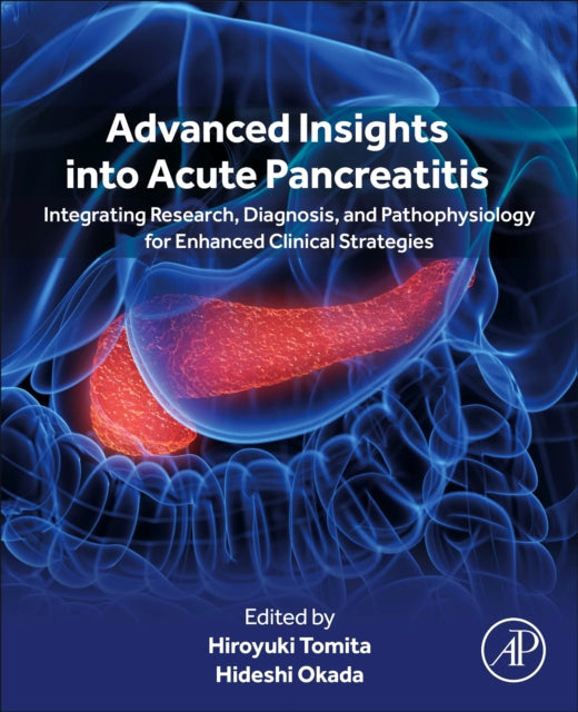 Advanced Insights into Acute Pancreatitis: Integrating Research, Diagnosis, and Pathophysiology for Enhanced Clinical Strategies