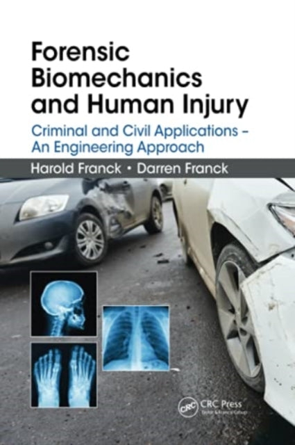 Forensic Biomechanics and Human Injury: Criminal and Civil Applications - An Engineering Approach