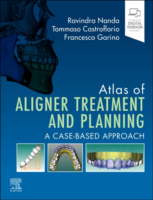 Atlas of Aligner Treatment and Planning cover