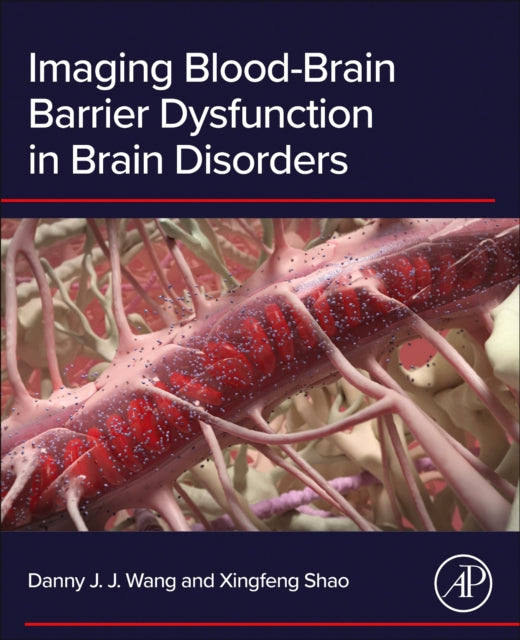 Imaging Blood-Brain Barrier Dysfunction in Brain Disorders cover