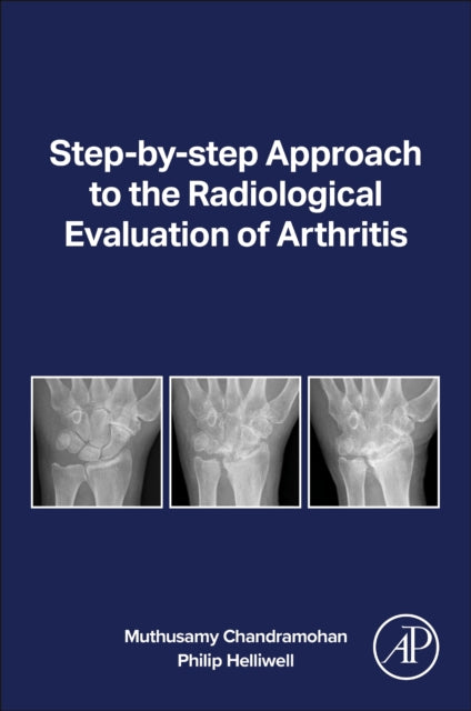 Step-by-step Approach to the Radiological Evaluation of Arthritis cover