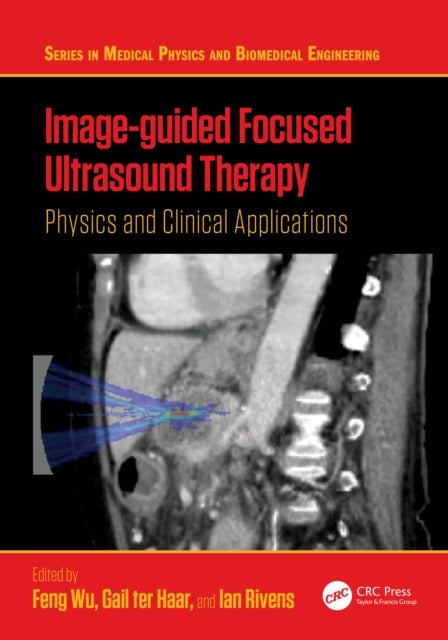 Image-guided Focused Ultrasound Therapy cover
