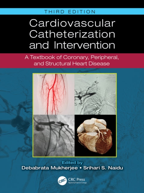Cardiovascular Catheterization and Intervention cover