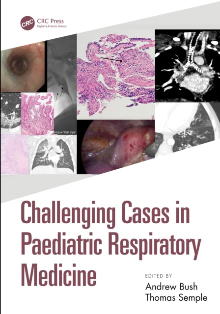 Challenging Cases in Paediatric Respiratory Medicine cover
