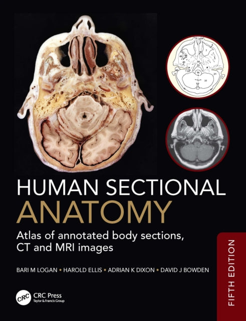 Human Sectional Anatomy cover