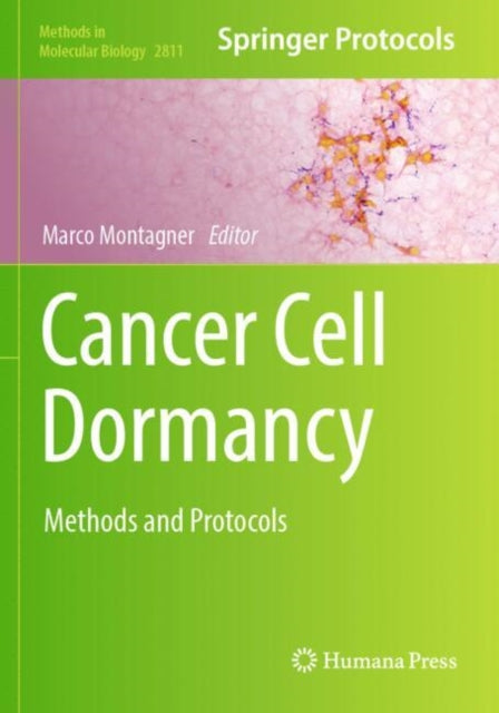 Cancer Cell Dormancy cover
