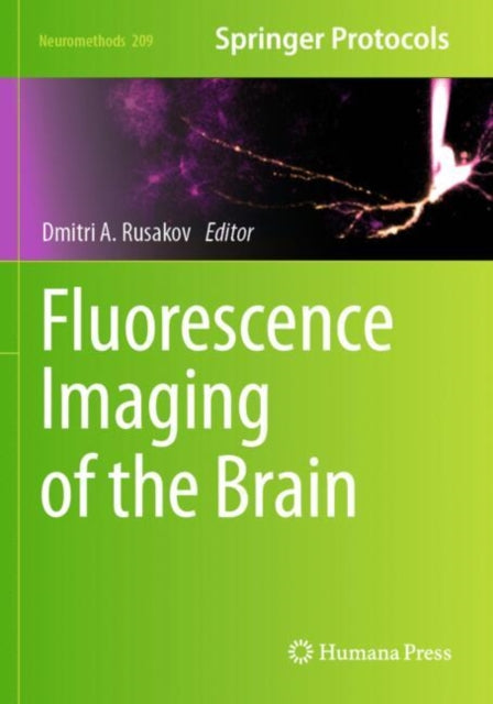 Fluorescence Imaging of the Brain cover
