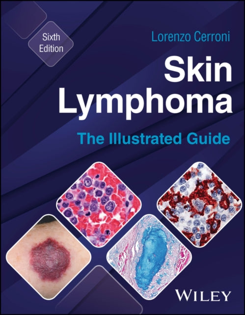 Skin Lymphoma cover