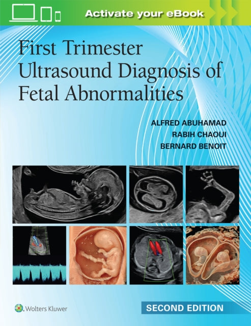 First Trimester Ultrasound Diagnosis of Fetal Abnormalities cover