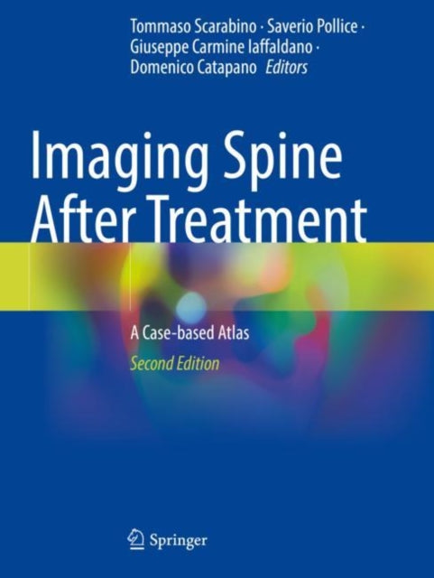 Imaging Spine After Treatment cover