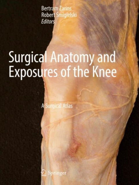 Surgical Anatomy and Exposures of the Knee cover