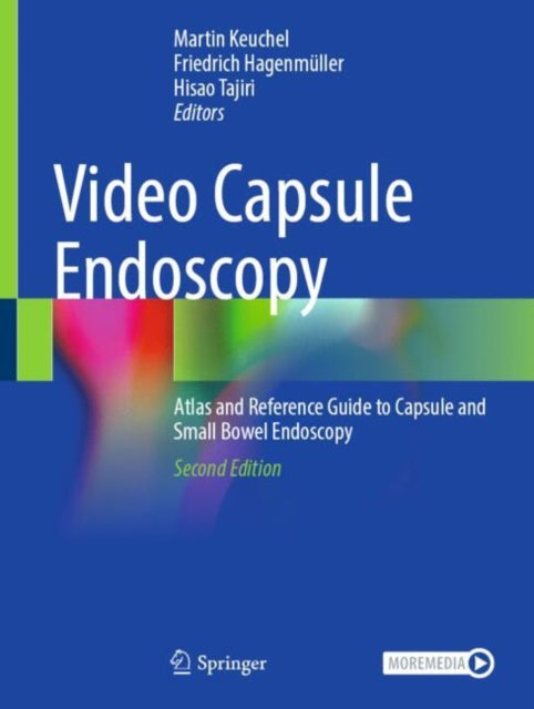 Video Capsule Endoscopy cover