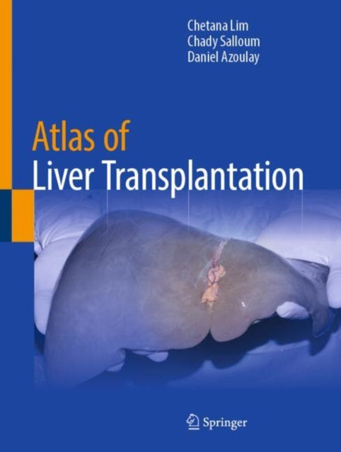 Atlas of Liver Transplantation cover