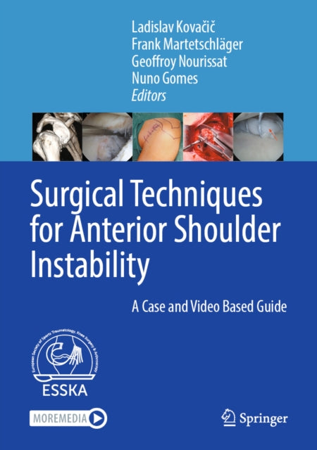 Surgical Techniques for Anterior Shoulder Instability cover