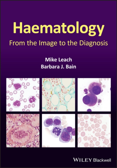 Haematology: From the Image to the Diagnosis