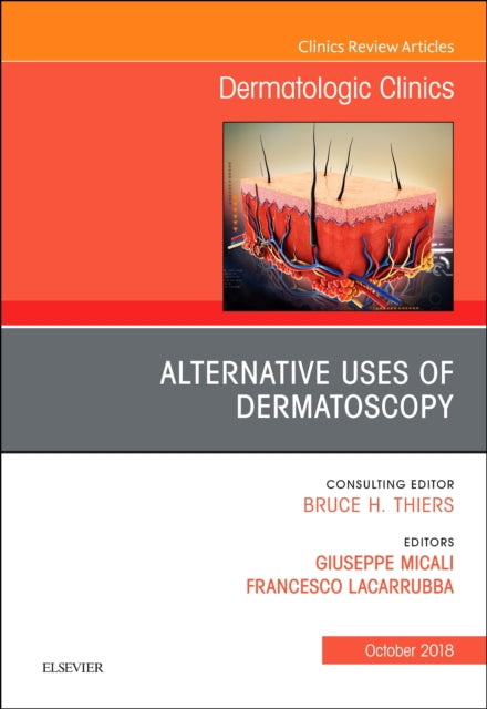 Alternative Uses of Dermatoscopy, An Issue of Dermatologic Clinics