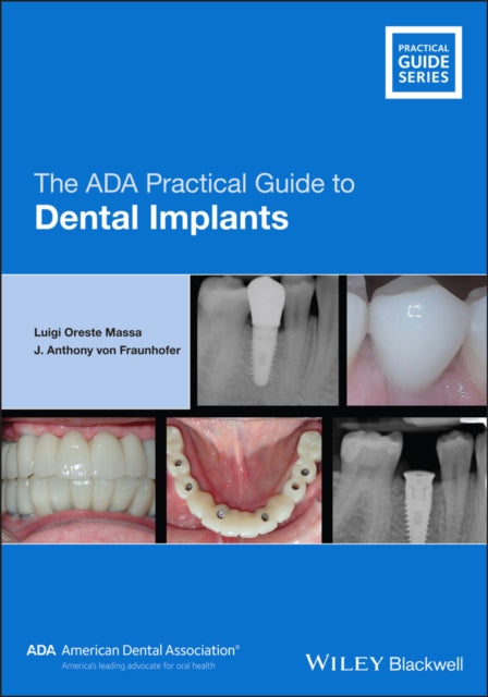 ADA Practical Guide to Dental Implants