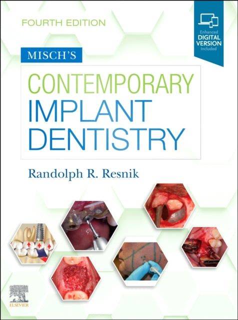 Misch's Contemporary Implant Dentistry