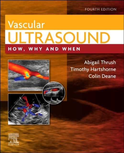 Vascular Ultrasound: How, Why and When