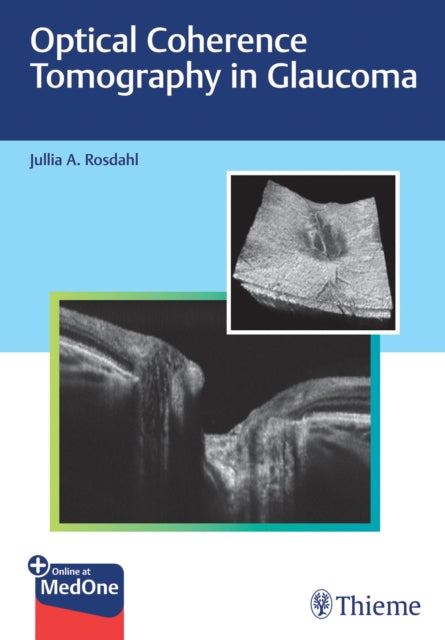 Optical Coherence Tomography in Glaucoma