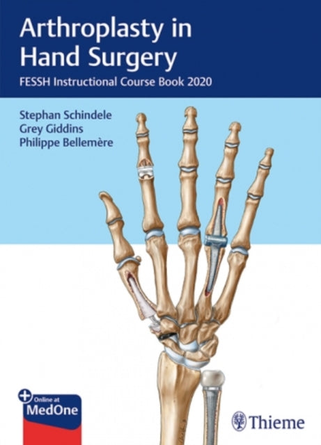 Arthroplasty in Hand Surgery: FESSH Instructional Course Book 2020