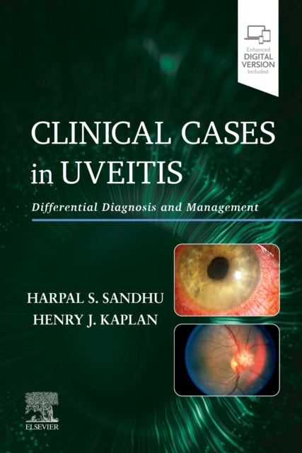 Clinical Cases in Uveitis: Differential Diagnosis and Management