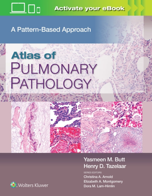 Atlas of Pulmonary Pathology: A Pattern Based Approach