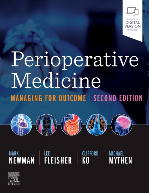 Perioperative Medicine: Managing for Outcome