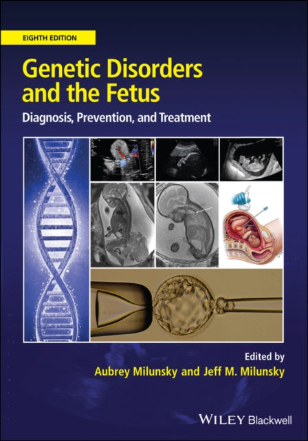 Genetic Disorders and the Fetus: Diagnosis, Prevention and Treatment