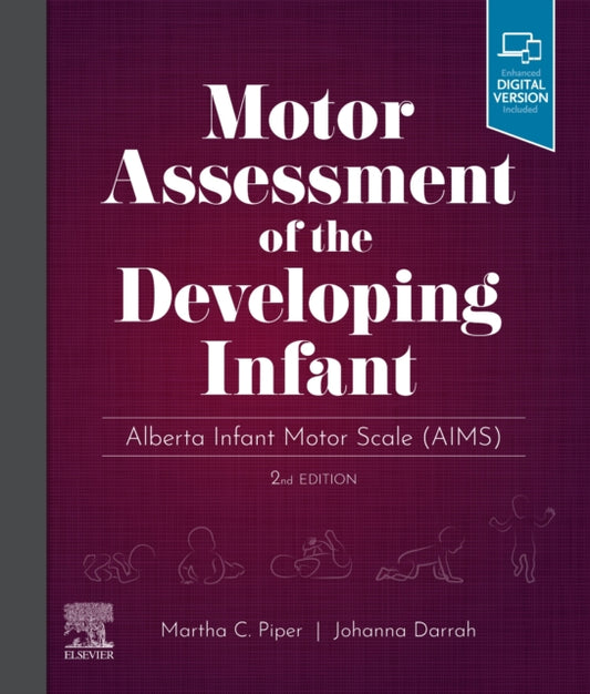 Motor Assessment of the Developing Infant: Alberta Infant Motor Scale (AIMS)