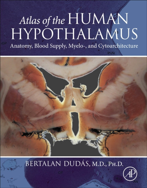 Atlas of the Human Hypothalamus: Anatomy, Blood Supply, Myelo-, and Cytoarchitecture