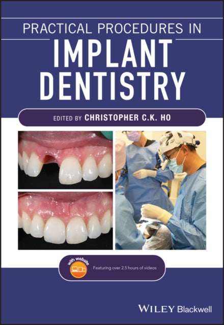 Practical Procedures in Implant Dentistry