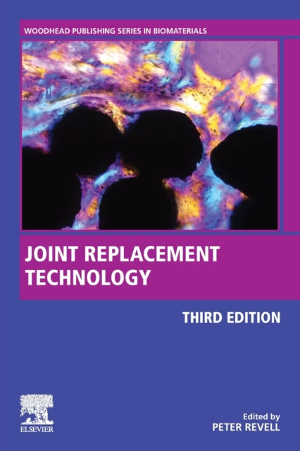 Joint Replacement Technology