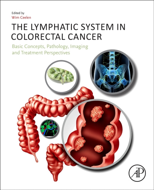 The Lymphatic System in Colorectal Cancer: Basic Concepts, Pathology, Imaging, and Treatment Perspectives