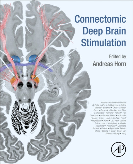 Connectomic Deep Brain Stimulation