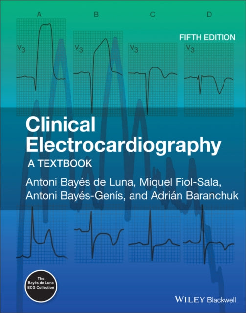 Clinical Electrocardiography: A Textbook