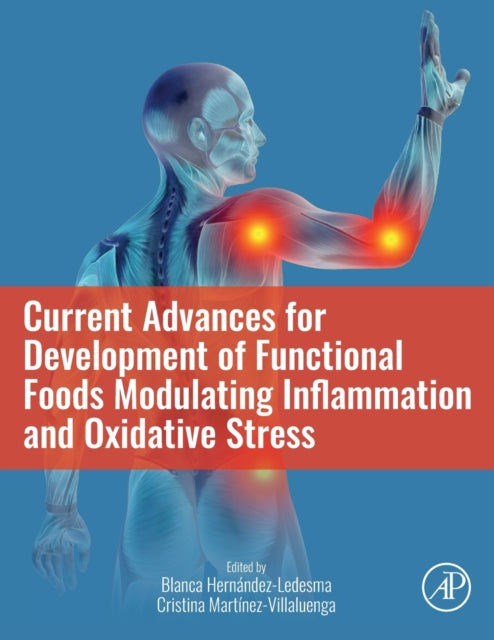 Current Advances for Development of Functional Foods Modulating Inflammation and Oxidative Stress