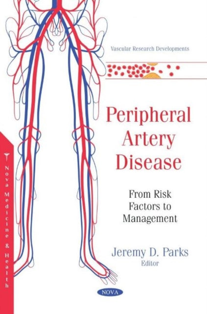 Peripheral Artery Disease: From Risk Factors to Management