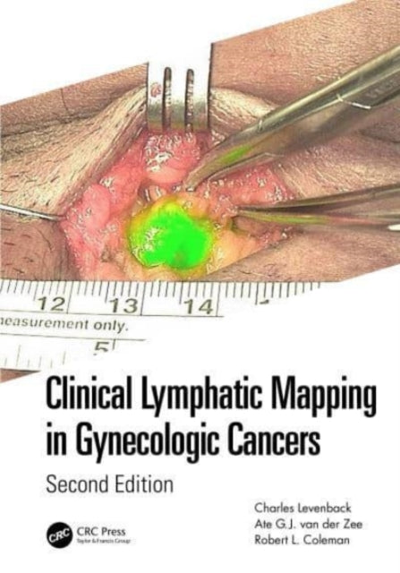 Clinical Lymphatic Mapping in Gynecologic Cancers