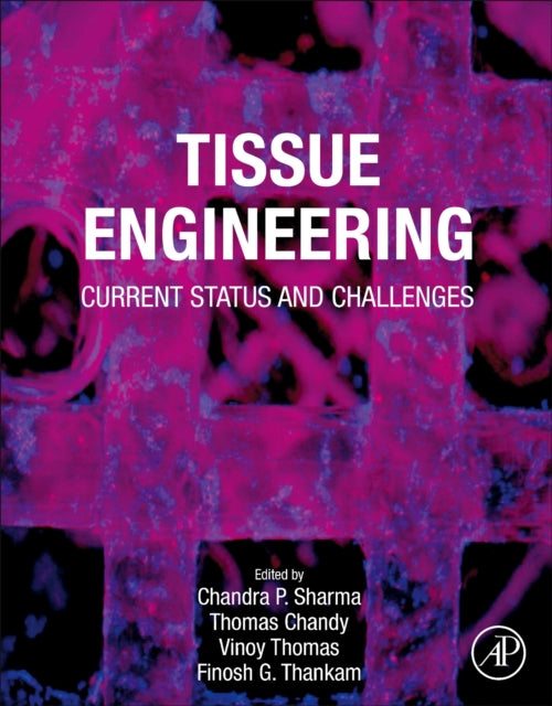 Tissue Engineering: Current Status and Challenges