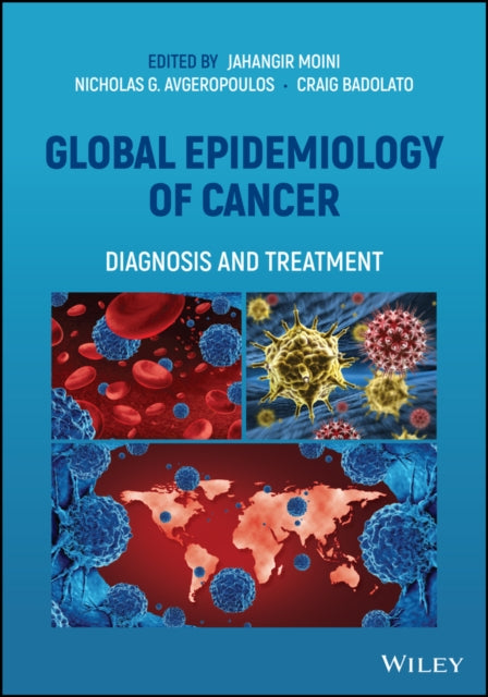 Global Epidemiology of Cancer: Diagnosis and Treatment