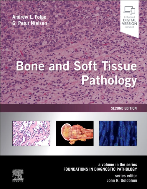 Bone and Soft Tissue Pathology: A volume in the series Foundations in Diagnostic Pathology