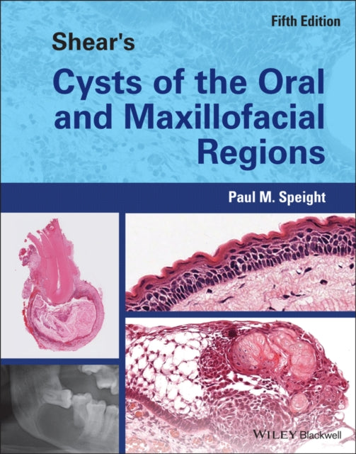 Shear's Cysts of the Oral and Maxillofacial Region s 5th Edition