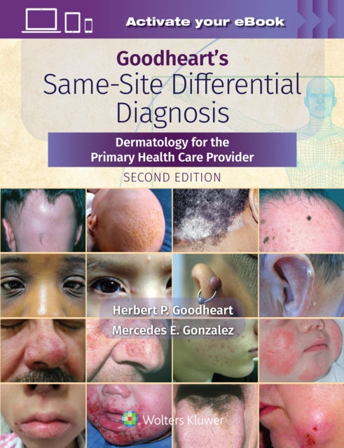 Goodheart's Same-Site Differential Diagnosis: Dermatology for the Primary Health Care Provider