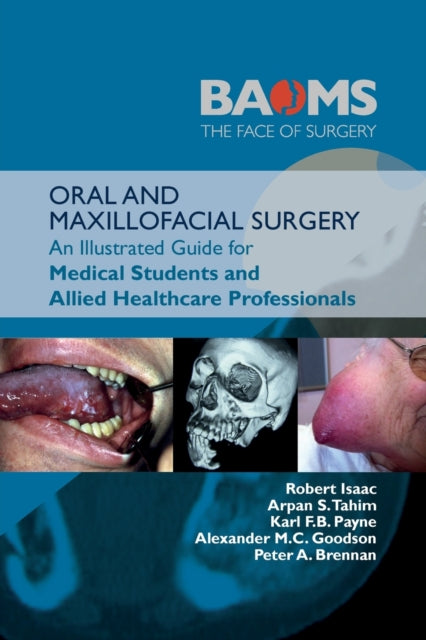 ORAL AND MAXILLOFACIAL SURGERY: An Illustrated Guide for Medical Students and Allied Healthcare Professionals