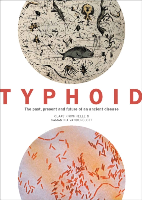 Typhoid: The past, present, and future of an ancient disease