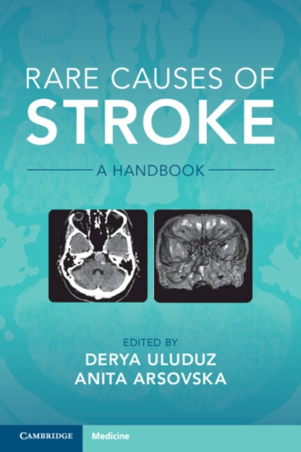 Rare Causes of Stroke: A Handbook