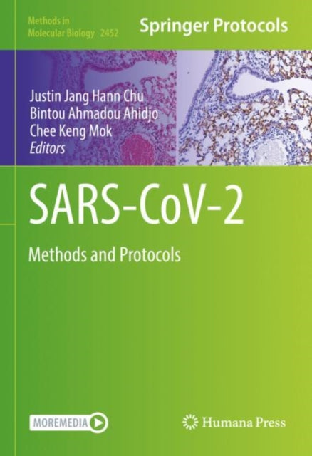 SARS-CoV-2: Methods and Protocols