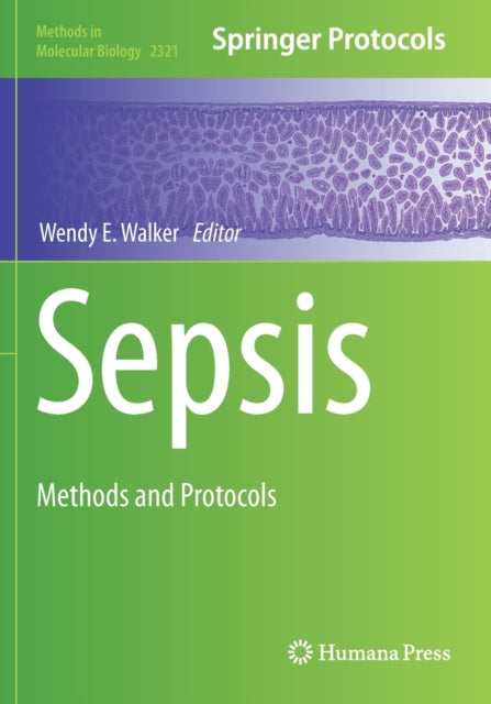 Sepsis: Methods and Protocols