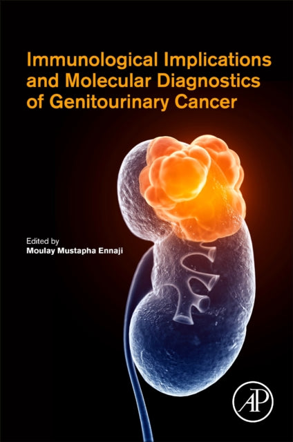 Immunological Implications and Molecular Diagnostics of Genitourinary Cancer